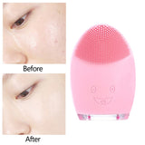 Electric Vibrating Exfoliator